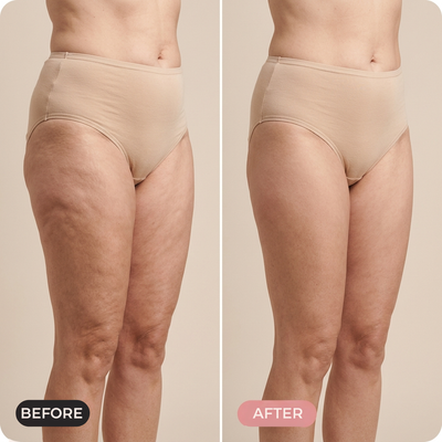 Flexitrener CoreShaper – before and after